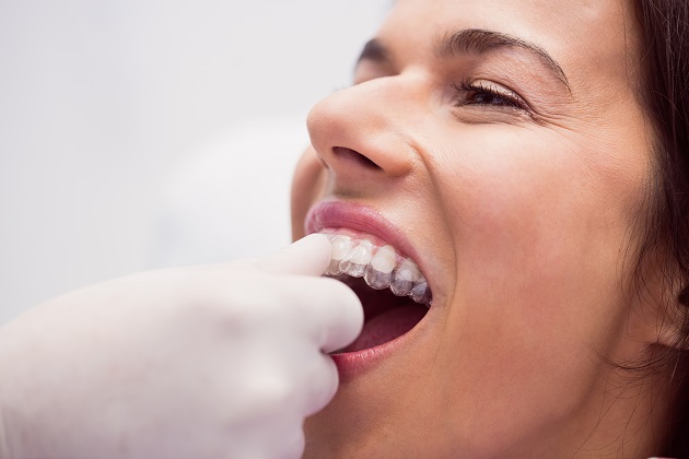 invisalign en Nou Barris